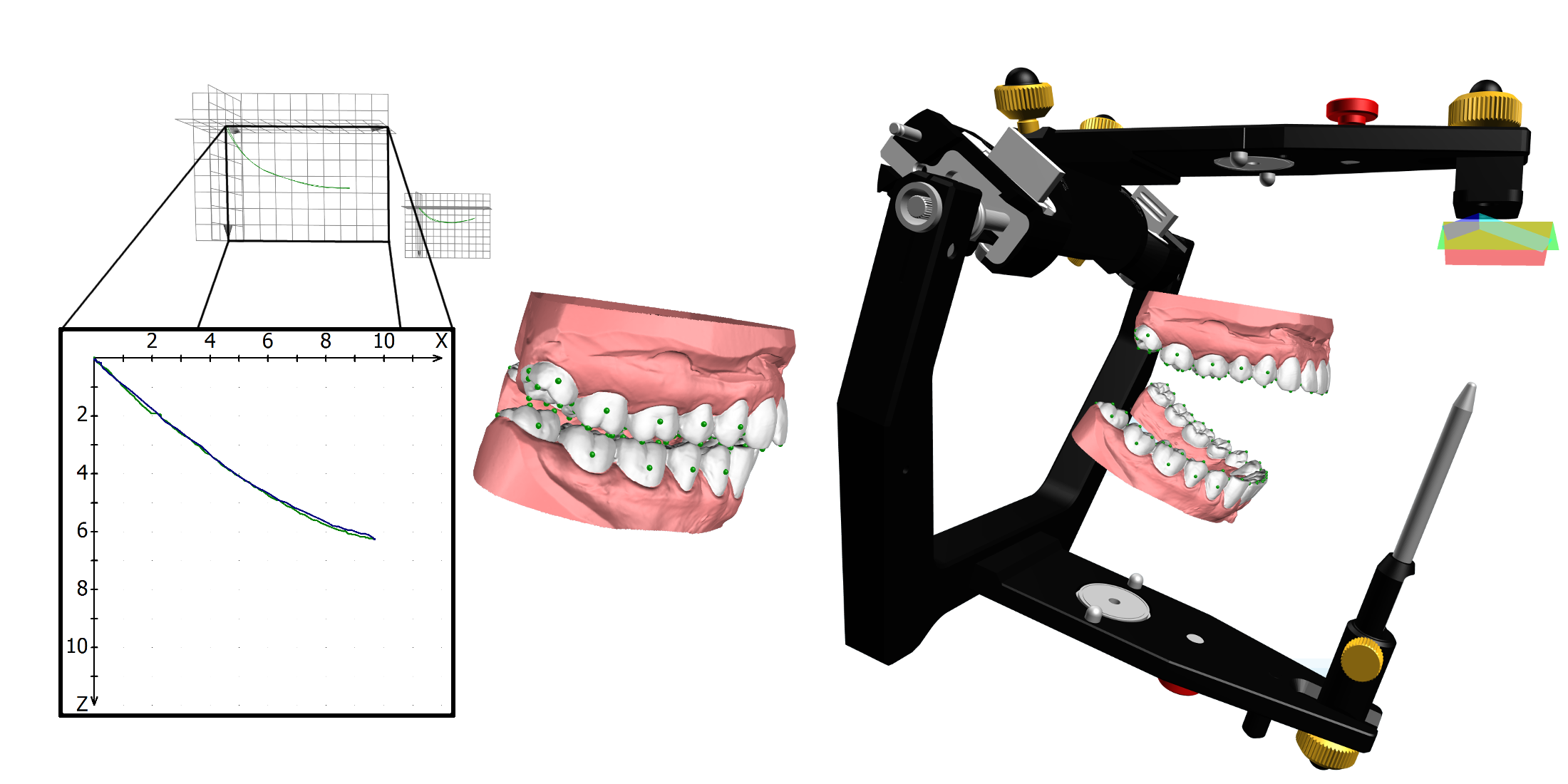 Artikulation GAMMA Dental